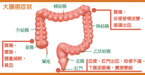 臨床腫瘤科 檢測 診斷 治療及預防癌症 Hk Clinical Oncology