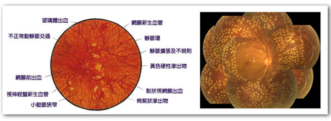 視網膜