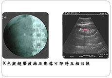 結石治療中心儀器插圖