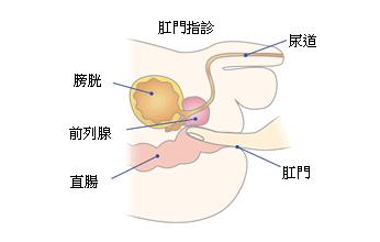 肛門指診