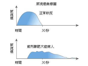 尿流速測定